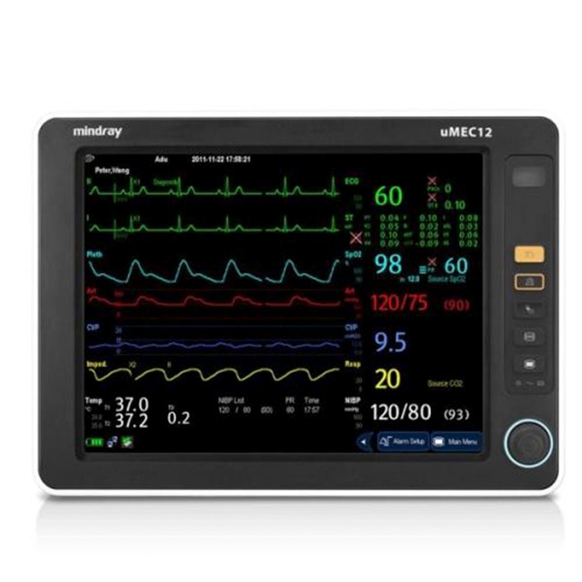 Monitor Mindrey Mindray uMEC12 Patient Monitor ECG | Mindray Accessories Australia– LSR ...