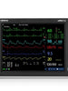 Mindray uMEC12 Patient Monitor ECG, Resp, SpO2, NIBP, 2-ch TEMP - LSR HealthcareMindray uMEC12 Patient Monitor ECG, Resp, SpO2, NIBP, 2-ch TEMP