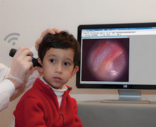 Firefly DE550 Wireless Digital Video Otoscope
