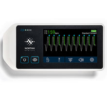 Foetal smart-sync Cardiac MRI Gating with Doppler Ultrasound
