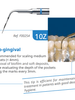 Acteon Dental N.10Z Scaler Tip - LSR HealthcareActeon Dental N.10Z Scaler Tip