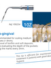Acteon Dental N.10Z Scaler Tip