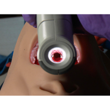 Vie Scope® Laryngoscope